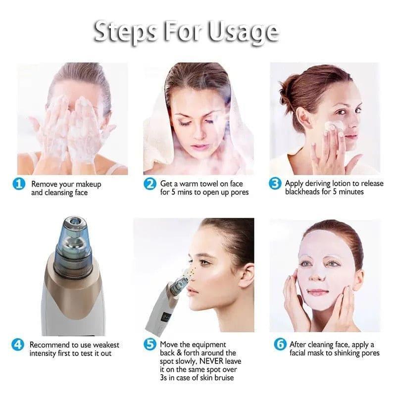*Product Name*: Remove Impurities - 1 Pcs Black Head Remover for Clean and Clear Skin