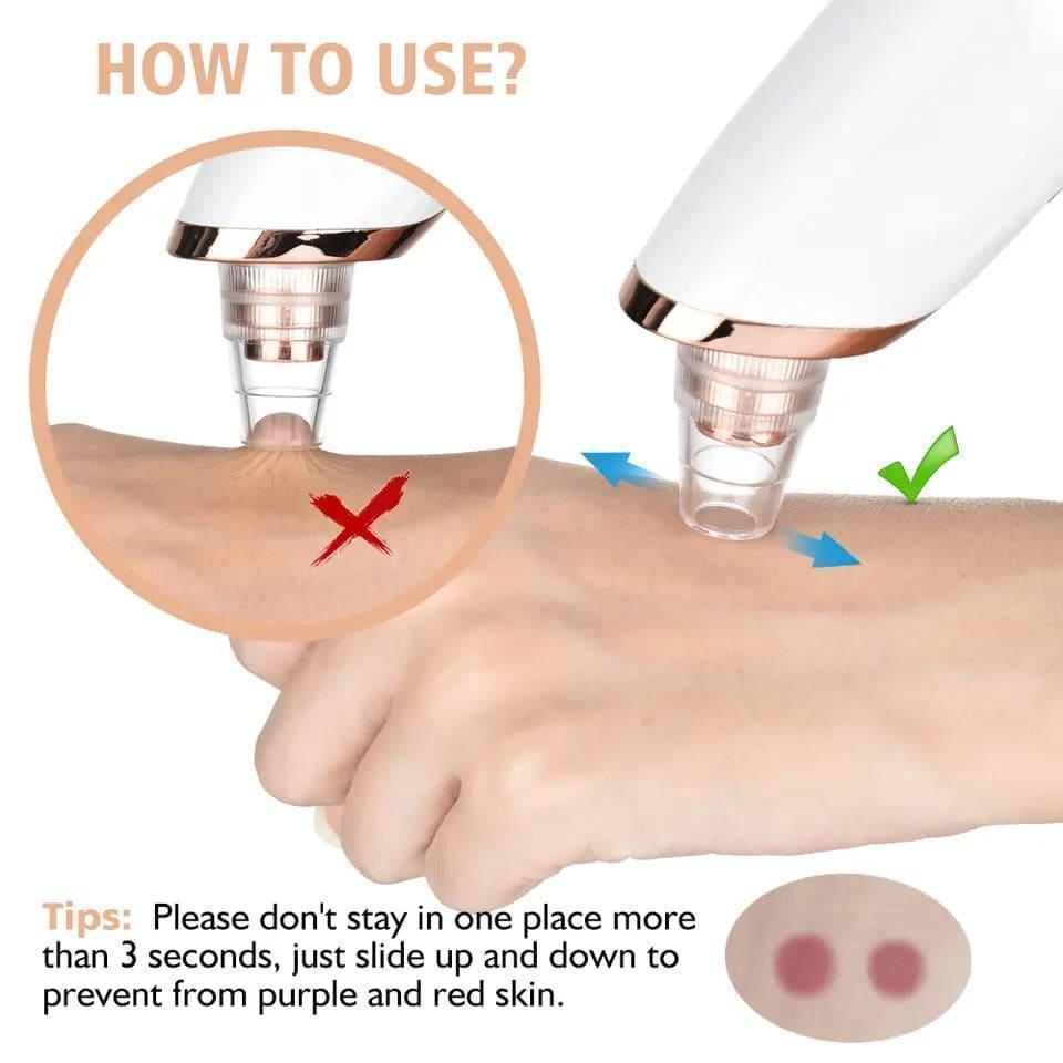 *Product Name*: Remove Impurities - 1 Pcs Black Head Remover for Clean and Clear Skin